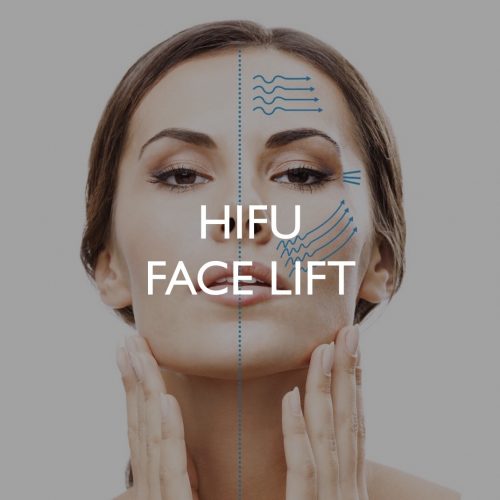 HIFU Face Lift