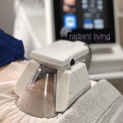 How does Fat Freeze work?